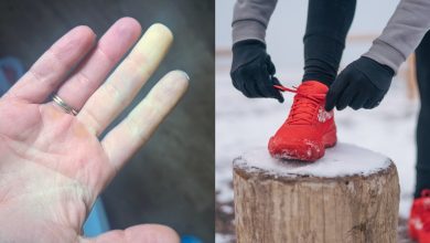 how-to-exercise-outside-with-raynaud’s-syndrome-without-freezing-your-fingers-off